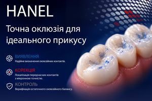 Артикуляційний папір та фольга: матеріали для точного контролю оклюзії фото